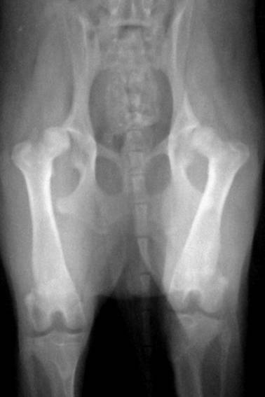a csípőízület röntgenbetegségei ízületi fájdalom könyök és térd kezelés