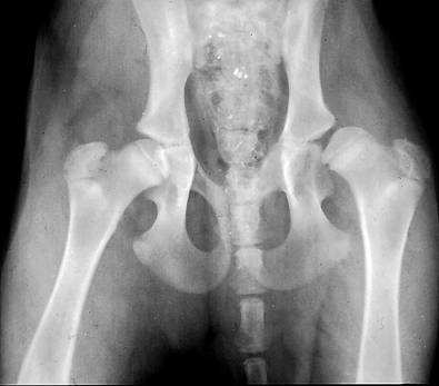 1. fokú csípő dysplasia kezelése, A csípő kopásos megbetegedése (coxarthrosis)