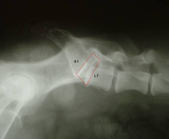 Nyaki osteochondrozis gyanúja sérv c6-c7. A nyak bal oldalán fáj - Epilepszia August