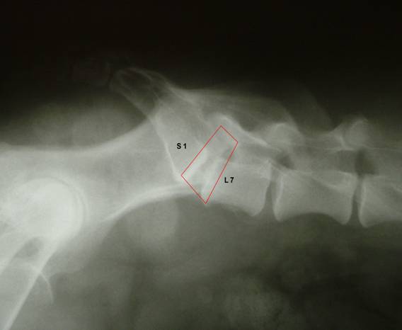 keresztcsonti osteochondrosis